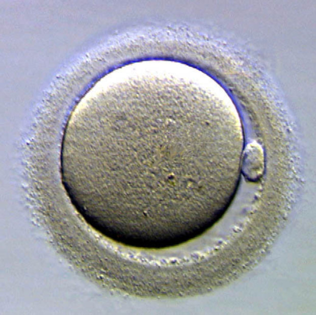 Ovule