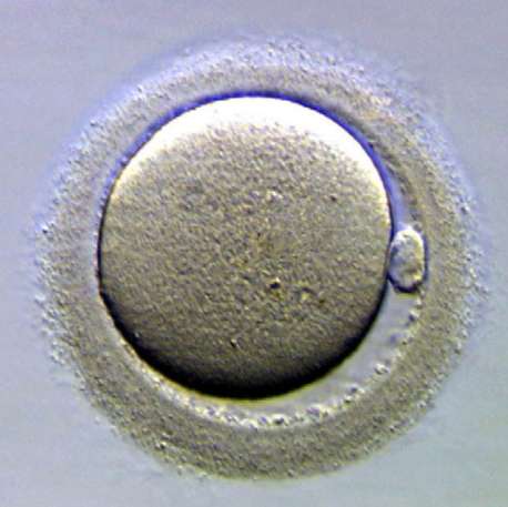 Ovule